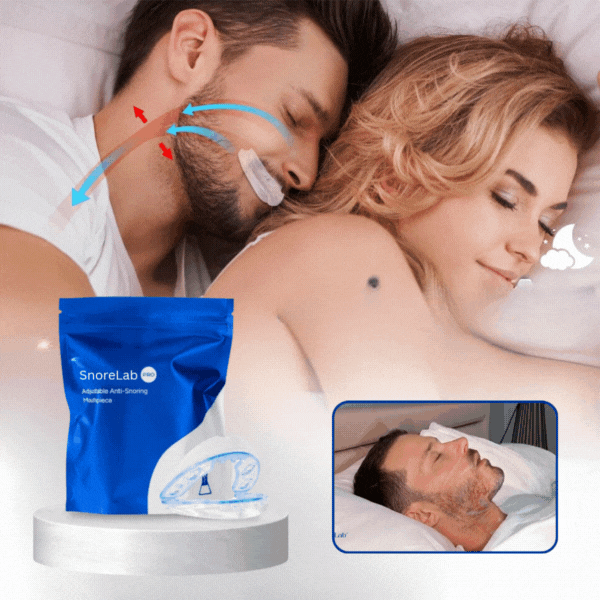 SnoreLab™ Antisnarkningsmunstycke | Sluta snarka – redan efter en natt!